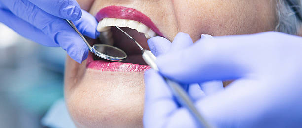Best Emergency TMJ Treatment in Rosedale, CA
